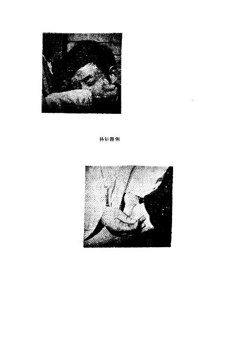 刺血疗法 封面