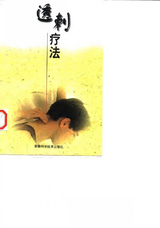 透刺疗法 封面