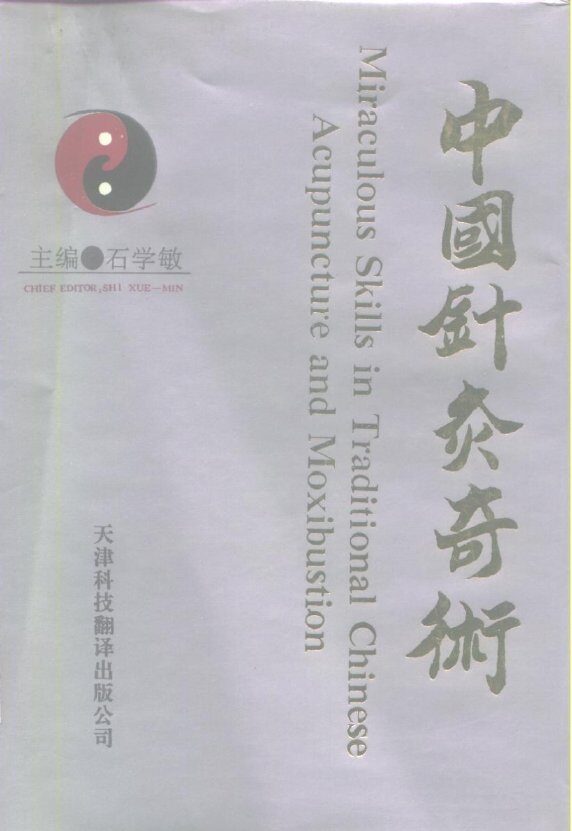 中国针灸奇术 封面