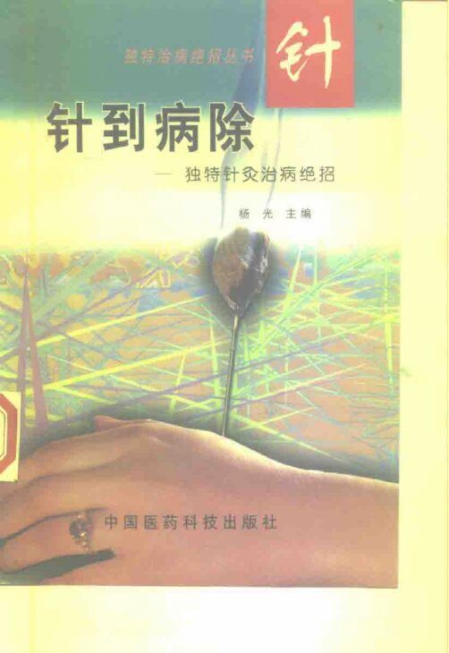 针到病除  独特针灸治病绝招 封面