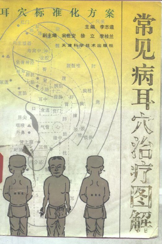 常见病耳穴治疗图解  耳穴标准化方案 封面