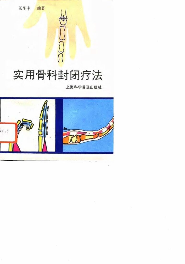 实用骨科封闭疗法 封面