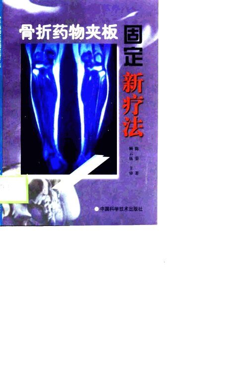 骨折药物夹板固定新疗法 封面