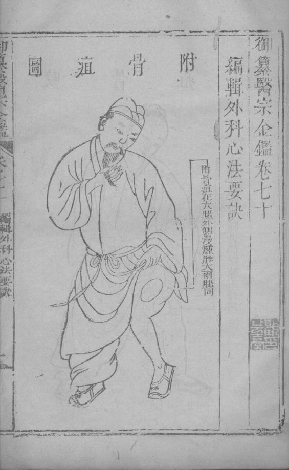 医宗金鉴  卷70 封面
