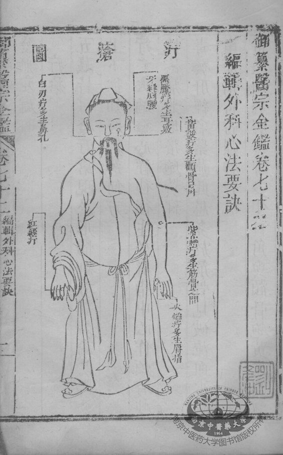 医宗金鉴  卷72-73 封面