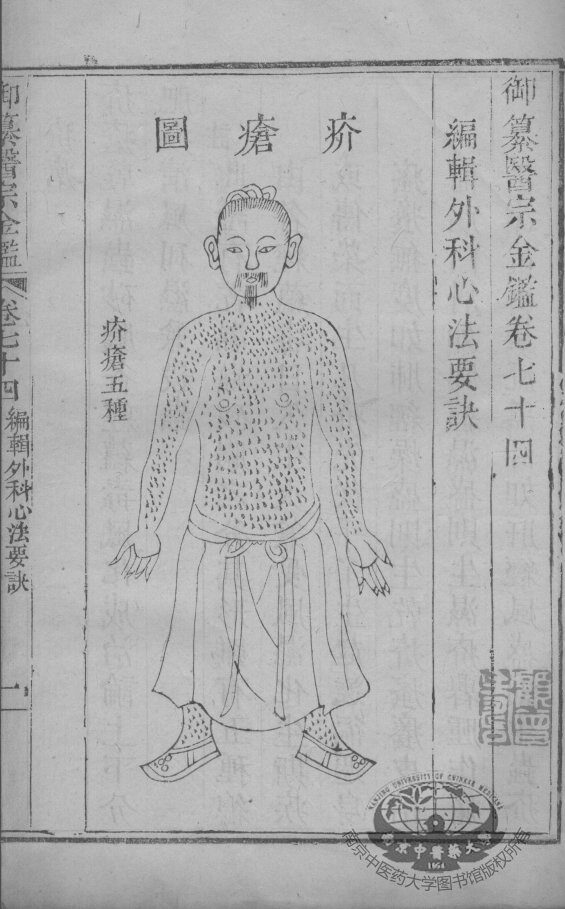 医宗金鉴  卷74-75 封面