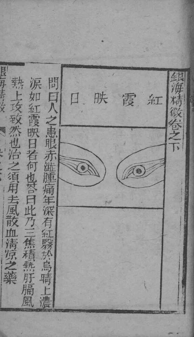 银海精微  卷下 封面