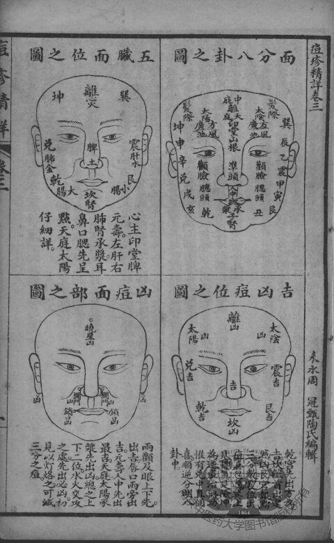 痘疹精详  卷3 封面