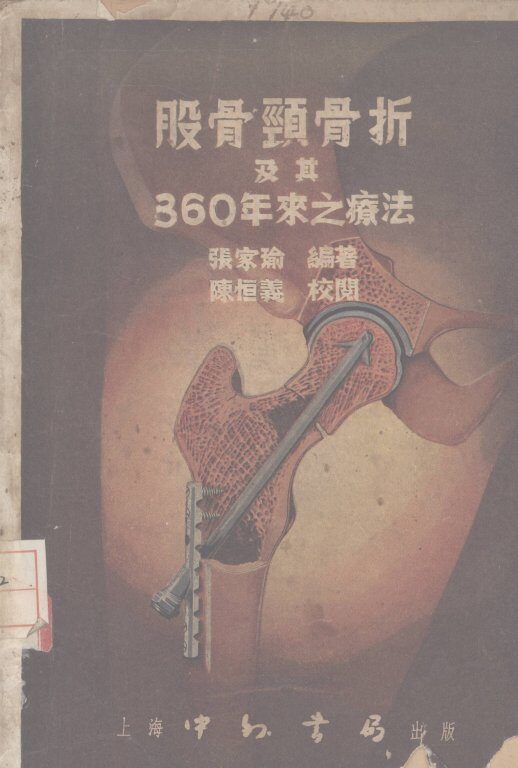 股骨颈骨折及其360年来之疗法 封面