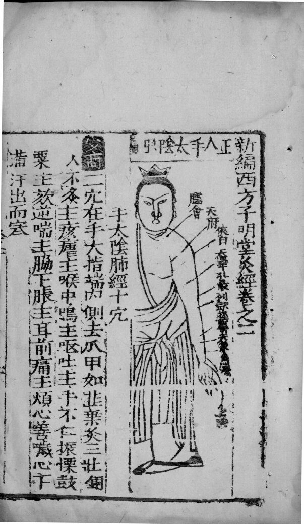新编西方子明堂灸经  卷2 封面