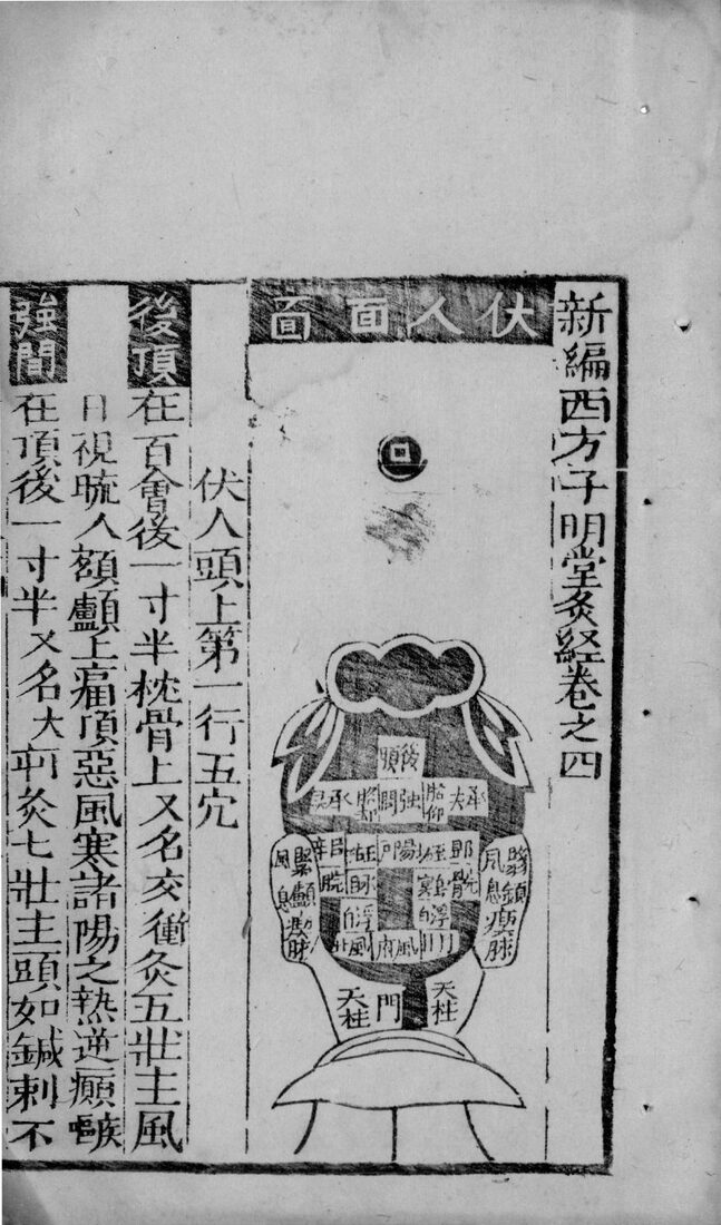新编西方子明堂灸经  卷4 封面