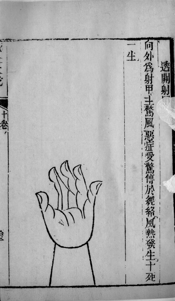 针灸大成  32 封面